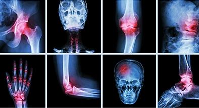 xrays